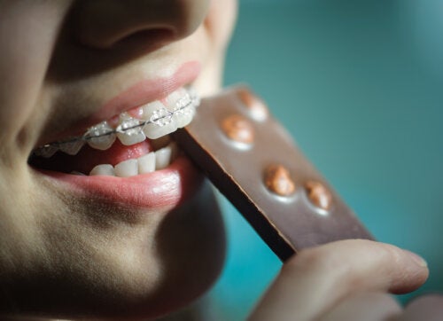 6 aliments à éviter si vos enfants portent un appareil dentaire