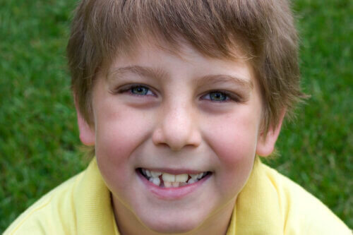 Les nouvelles dents de mon enfant sont jaunes, est-ce normal ?