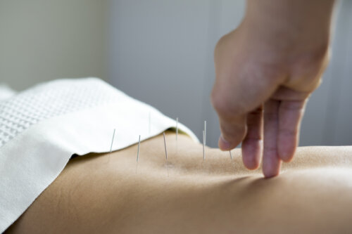 L'acupuncture pour tomber enceinte : est-ce que ça marche ?
