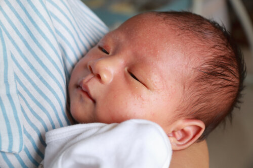 Allergie au lait chez les bébés: ce qu'il faut savoir