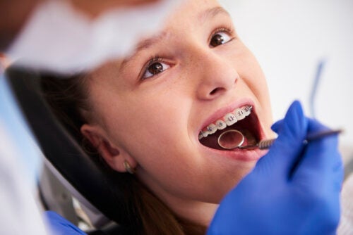 Orthodontie précoce chez l'enfant : expansion ou extractions dentaires ?