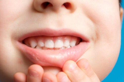 L'émail peut-il repousser sur les dents des enfants ?