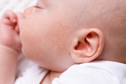 Boutons sur le visage du bébé : à quoi sont-ils dus et que faire ?