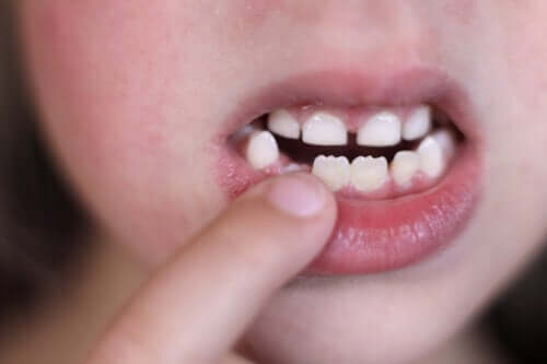 Dents en forme de scie : est-ce normal ?