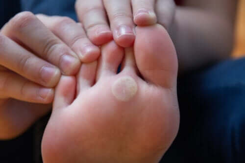 Verrues plantaires chez les enfants : causes et traitements