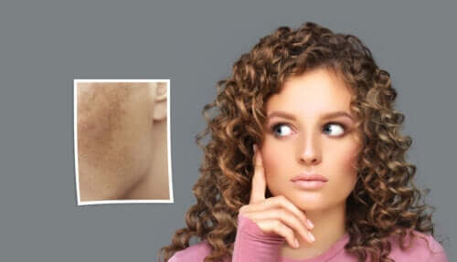 Taches sur le visage pendant la grossesse : traitement