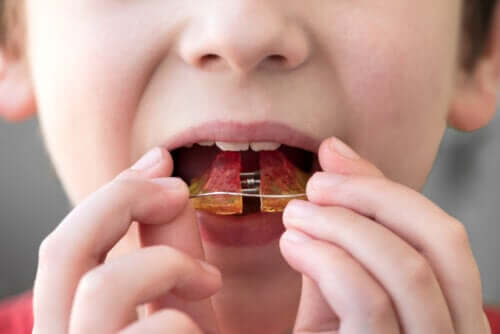Orthodontie infantile: à quel âge peut-elle commencer ?