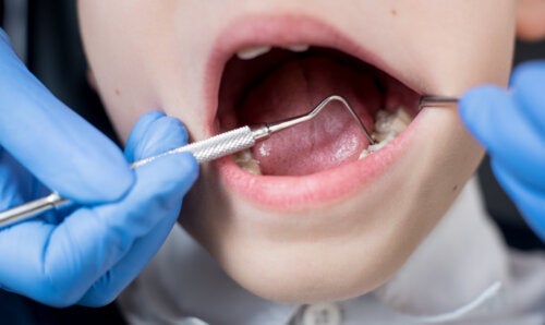 Les 6 traitements dentaires les plus courants chez les enfants