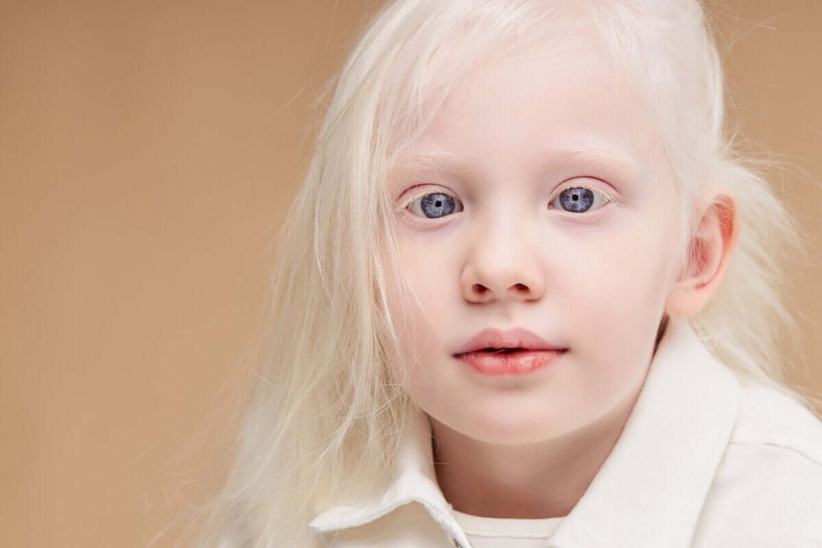 Comment prendre soin de la peau d'un enfant albinos?