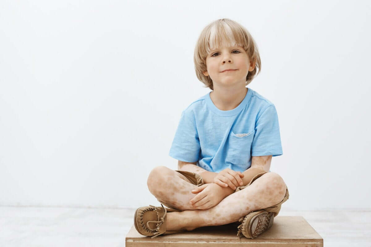 Types d'aliments pour améliorer le vitiligo chez les enfants