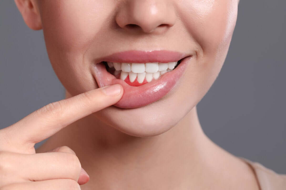 Gencives enflées pendant la grossesse: causes et solutions