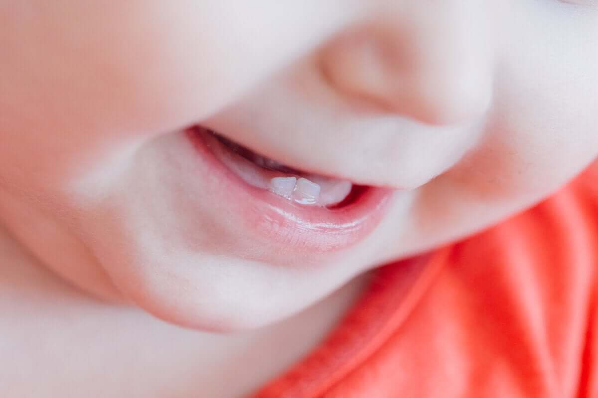 L'éruption dentaire peut-elle provoquer un érythème fessier?