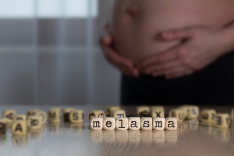 Quelles sont les causes du chloasma pendant la grossesse ?